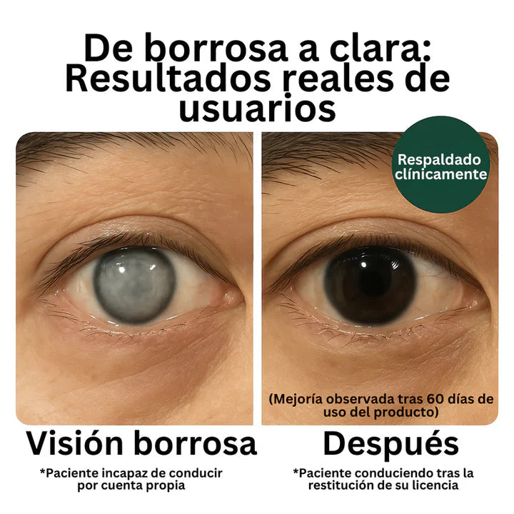 ZOONE CAPSULAS PARA LOS OJOS